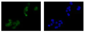 Immunocytochemistry/ Immunofluorescence - Anti-PPP2R5D antibody [EPR15617] (AB188323)