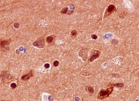 Anti-PPP2R5D antibody [EPR15617] KO Tested (ab188323) | Abcam