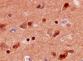 Immunohistochemistry (Formalin/PFA-fixed paraffin-embedded sections) - Anti-PPP2R5D antibody [EPR15617] (AB188323)