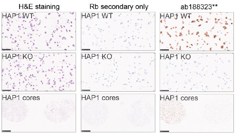 Anti-PPP2R5D antibody [EPR15617] KO Tested (ab188323) | Abcam