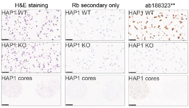 Immunohistochemistry (Formalin/PFA-fixed paraffin-embedded sections) - Anti-PPP2R5D antibody [EPR15617] (AB188323)