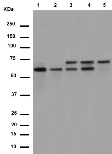 Western blot - Anti-PPP2R5D antibody [EPR15617] (AB188323)