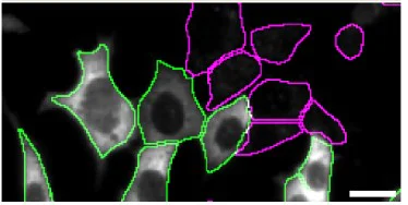 Immunocytochemistry/ Immunofluorescence - Anti-PPP2R5D antibody [EPR15617] - BSA and Azide free (AB250952)