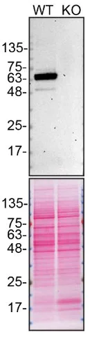 Western blot - Anti-PPP2R5D antibody [EPR15617] - BSA and Azide free (AB250952)