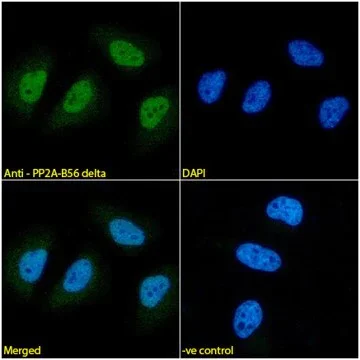 Immunocytochemistry/ Immunofluorescence - Anti-PPP2R5D Antibody [H5D12] (AB316368)