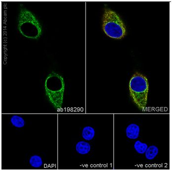 Immunocytochemistry/ Immunofluorescence - Anti-PPP2R5E antibody [EPR17146] (AB198290)