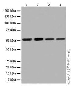 Western blot - Anti-PPP2R5E antibody [EPR17146] (AB198290)