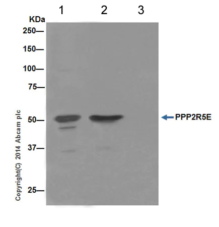 Immunoprecipitation - Anti-PPP2R5E antibody [EPR17147] - C-terminal (AB198500)