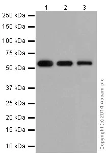 Western blot - Anti-PPP2R5E antibody [EPR17147] - C-terminal (AB198500)