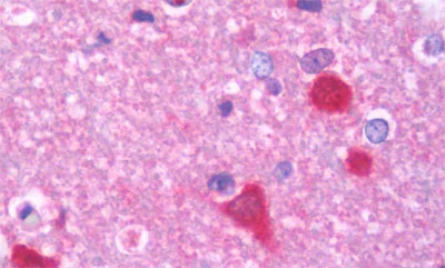 Immunohistochemistry (Formalin/PFA-fixed paraffin-embedded sections) - Anti-PPP3CB antibody (AB191374)