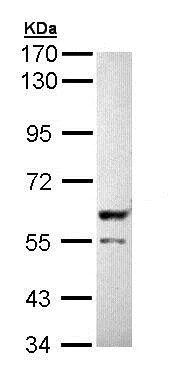 Western blot - Anti-PPP3CB antibody (AB191374)