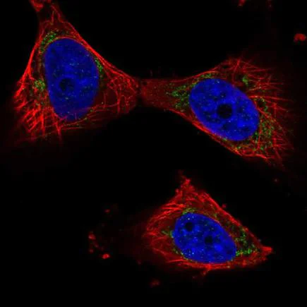 Immunocytochemistry/ Immunofluorescence - Anti-PPP3CB antibody (AB219984)