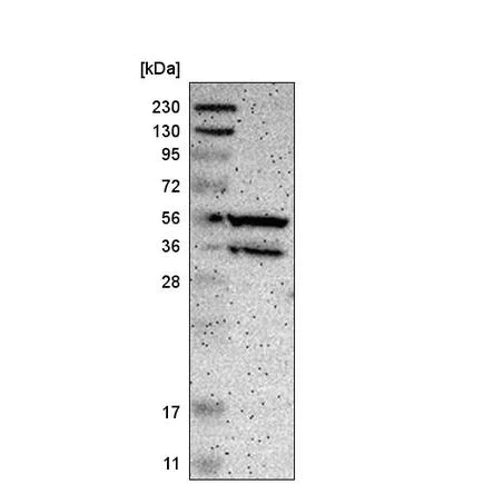 Western blot - Anti-PPP3CB antibody (AB219984)