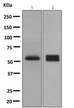 Western blot - Anti-PPP3CC antibody [EPR10601] - BSA and Azide free (AB249162)