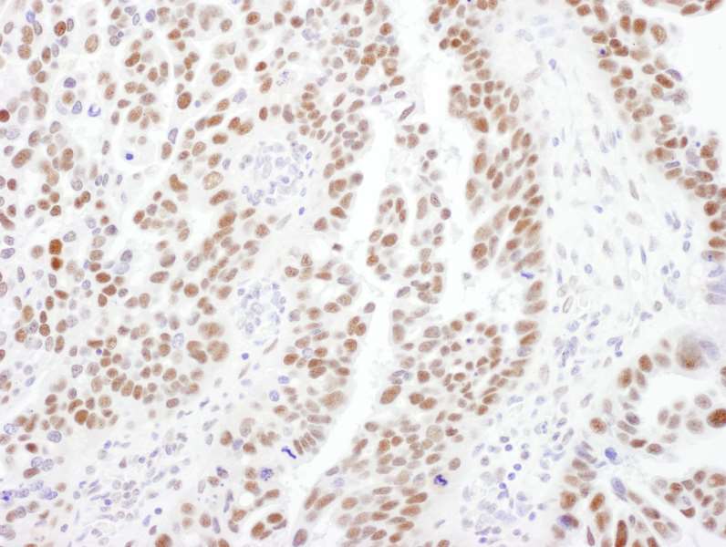 Immunohistochemistry (Formalin/PFA-fixed paraffin-embedded sections) - Anti-PPP4R2 antibody (AB70631)