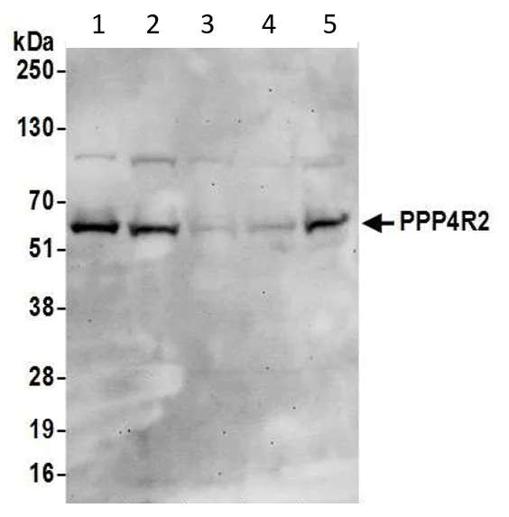 Western blot - Anti-PPP4R2 antibody (AB70631)