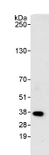 Immunoprecipitation - Anti-PPP6C/Ppv antibody (AB70634)