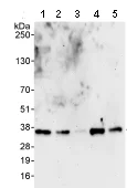 Western blot - Anti-PPP6C/Ppv antibody (AB70634)