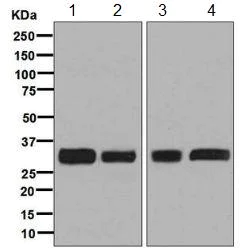 Western blot - Anti-PPP6C/Ppv antibody [EPR8764] - BSA and Azide free (AB248413)