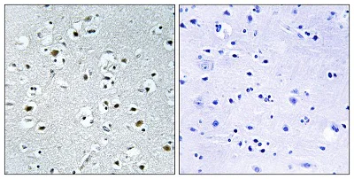Immunohistochemistry (Formalin/PFA-fixed paraffin-embedded sections) - Anti-PPRC1 antibody (AB196791)