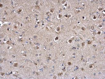 Immunohistochemistry (Formalin/PFA-fixed paraffin-embedded sections) - Anti-PPT1/PPT antibody (AB137578), expandable thumbnail