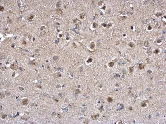 Immunohistochemistry (Formalin/PFA-fixed paraffin-embedded sections) - Anti-PPT1/PPT antibody (AB137578)