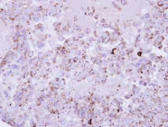 Immunohistochemistry (Formalin/PFA-fixed paraffin-embedded sections) - Anti-PPT1/PPT antibody (AB137578), expandable thumbnail