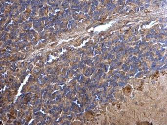 Immunohistochemistry (Formalin/PFA-fixed paraffin-embedded sections) - Anti-PPT1/PPT antibody (AB137578), expandable thumbnail