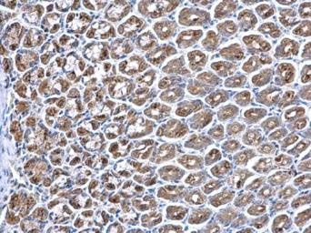 Immunohistochemistry (Formalin/PFA-fixed paraffin-embedded sections) - Anti-PPT1/PPT antibody (AB137578), expandable thumbnail