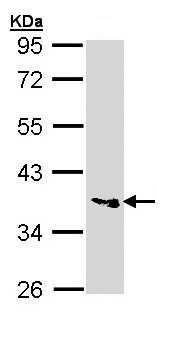 Western blot - Anti-PPT1/PPT antibody (AB137578), expandable thumbnail
