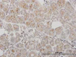 Immunohistochemistry (Formalin/PFA-fixed paraffin-embedded sections) - Anti-PPT1/PPT antibody (AB89022)