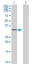 Western blot - Anti-PPT1/PPT antibody (AB89022)