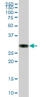 Western blot - Anti-PPT1/PPT antibody (AB89022)