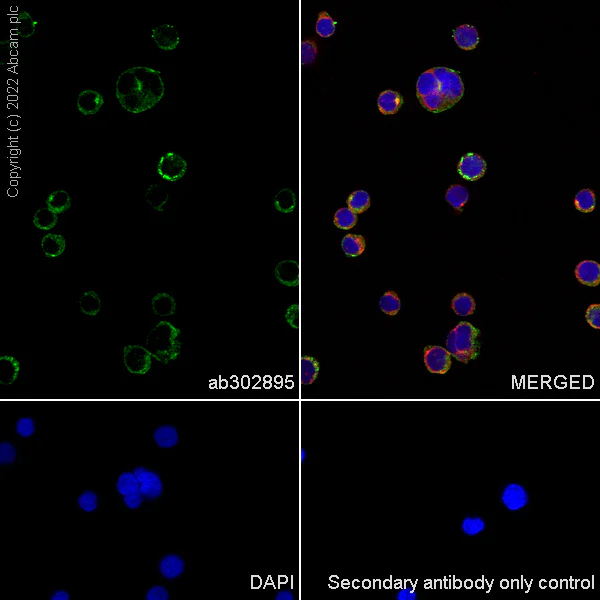 Immunocytochemistry - Anti-PPT1/PPT antibody [EPR27163-2] (BSA and Azide free) (AB302896)