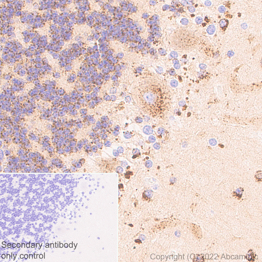 Immunohistochemistry - Anti-PPT1/PPT antibody [EPR27163-2] (BSA and Azide free) (AB302896), expandable thumbnail