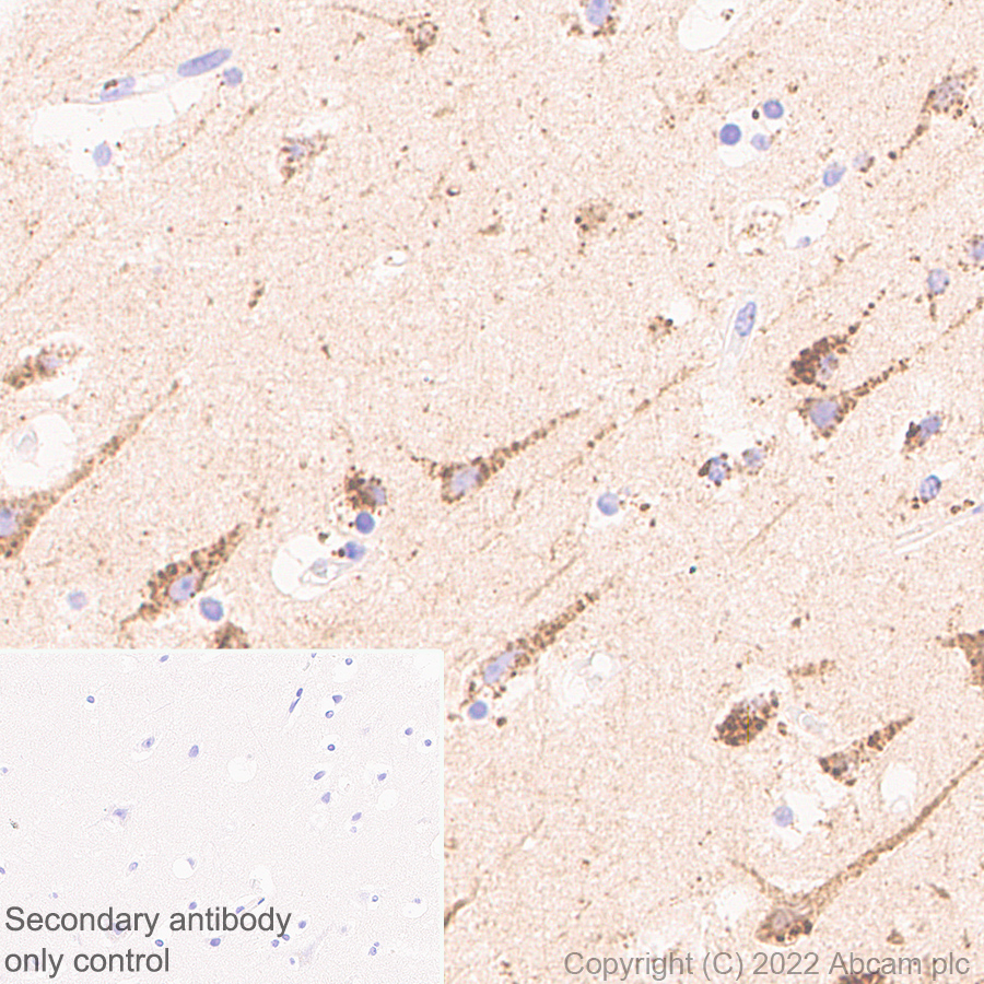 Immunohistochemistry - Anti-PPT1/PPT antibody [EPR27163-2] (BSA and Azide free) (AB302896), expandable thumbnail
