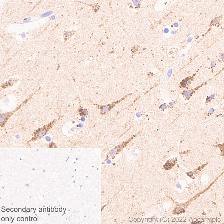 Immunohistochemistry - Anti-PPT1/PPT antibody [EPR27163-2] (BSA and Azide free) (AB302896)