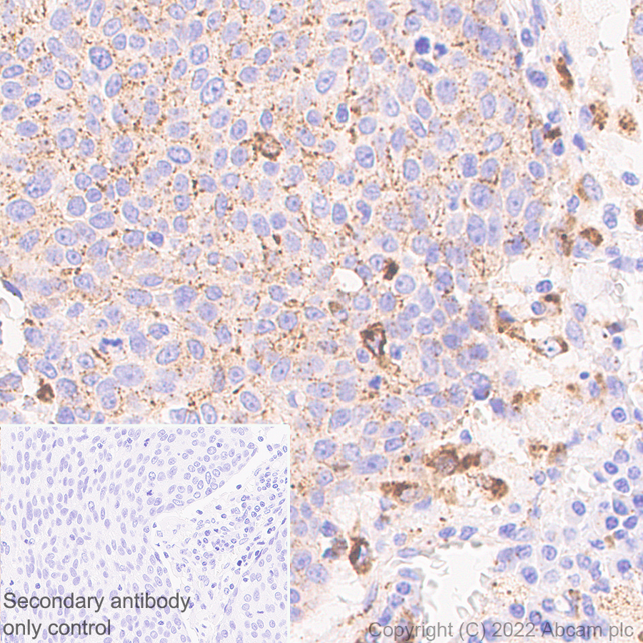 Immunohistochemistry - Anti-PPT1/PPT antibody [EPR27163-2] (BSA and Azide free) (AB302896), expandable thumbnail