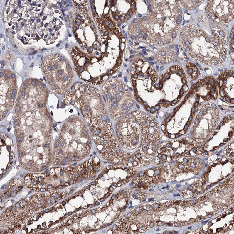 Immunohistochemistry (Formalin/PFA-fixed paraffin-embedded sections) - Anti-PPTC7 antibody (AB122548), expandable thumbnail