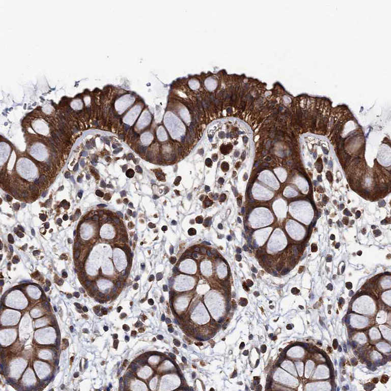 Immunohistochemistry (Formalin/PFA-fixed paraffin-embedded sections) - Anti-PPTC7 antibody (AB122548)