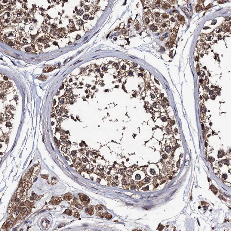Immunohistochemistry (Formalin/PFA-fixed paraffin-embedded sections) - Anti-PPTC7 antibody (AB122548)