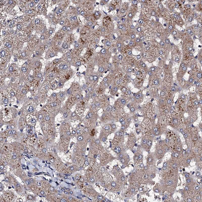 Immunohistochemistry (Formalin/PFA-fixed paraffin-embedded sections) - Anti-PPTC7 antibody (ab122548), expandable thumbnail