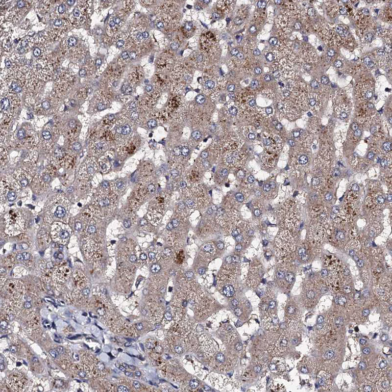 Immunohistochemistry (Formalin/PFA-fixed paraffin-embedded sections) - Anti-PPTC7 antibody (AB122548)