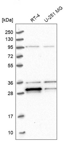 Western blot - Anti-PPTC7 antibody (AB122548), expandable thumbnail