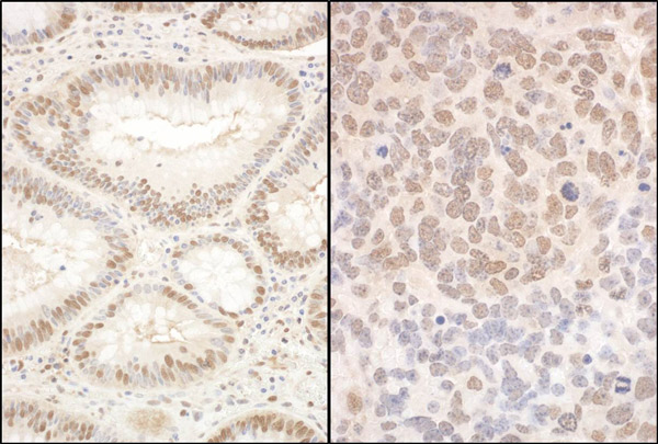 Immunohistochemistry (Formalin/PFA-fixed paraffin-embedded sections) - Anti-PQBP1 antibody (AB100797)
