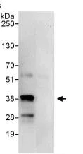 Immunoprecipitation - Anti-PQBP1 antibody (AB100797)