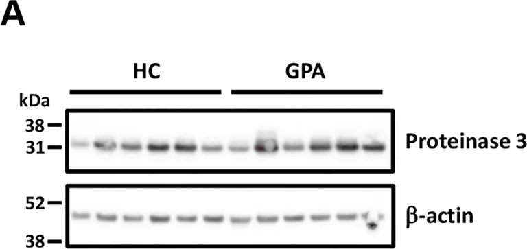 Western blot - Anti-PR3 antibody (AB103632)
