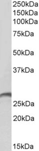 Western blot - Anti-PR3 antibody (AB191282)