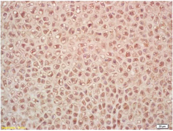 Immunohistochemistry (Formalin/PFA-fixed paraffin-embedded sections) - Anti-PR3 antibody (AB202968)