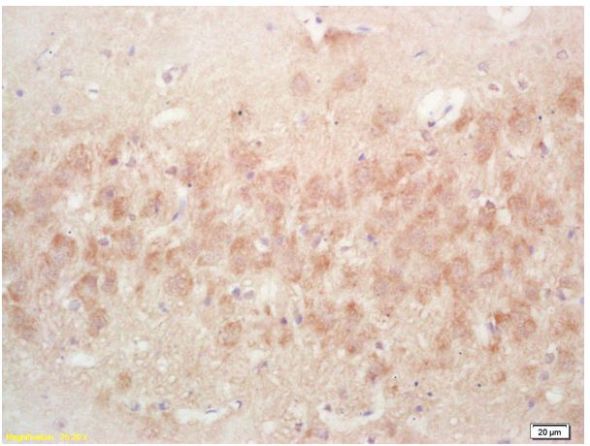 Immunohistochemistry (Formalin/PFA-fixed paraffin-embedded sections) - Anti-PR3 antibody (AB202968)